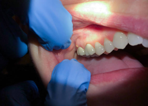 Urgent Tooth Repair in MO